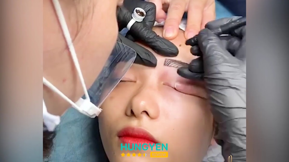 Thẩm Mỹ Nụ Trần – hình ảnh 2