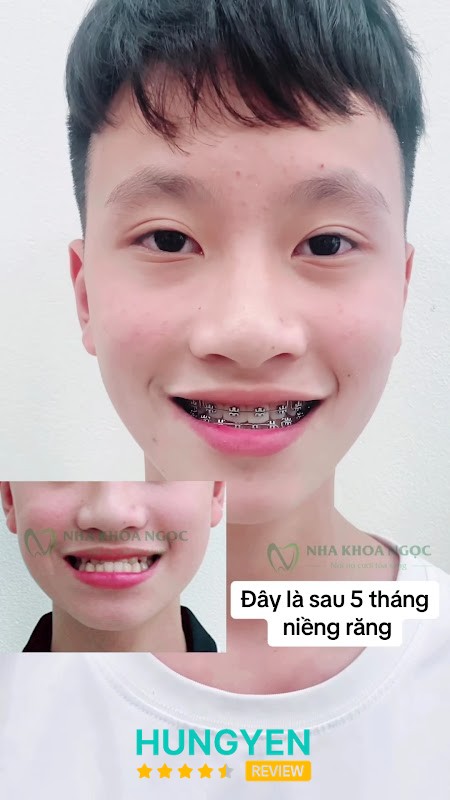 Nha khoa Ngọc Cơ Sở 4 – hình ảnh 2