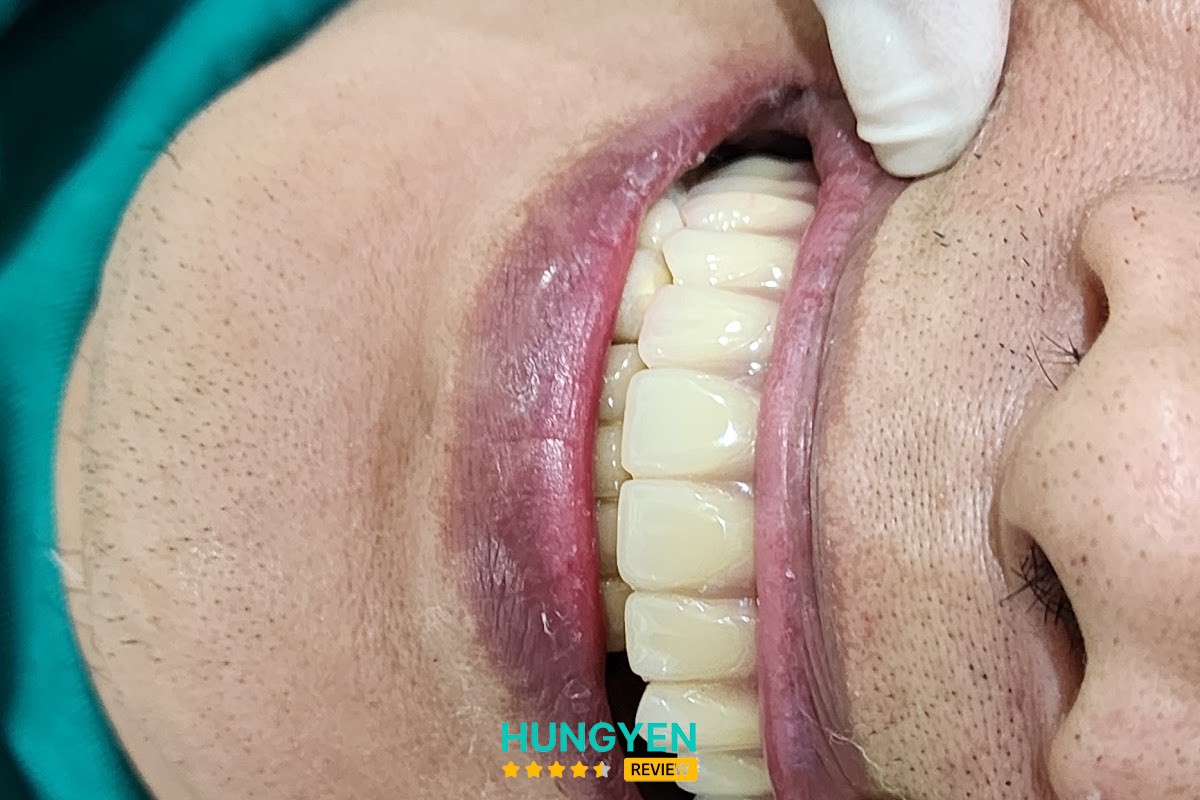 Nha Khoa Dr.Nga – hình ảnh 3