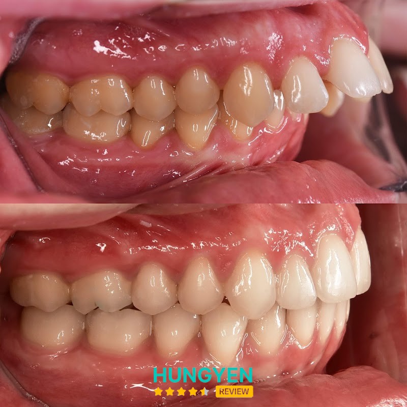 Nha khoa Asoka Văn Lâm Hưng Yên – hình ảnh 3