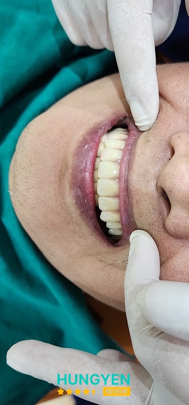Nha Khoa Quang Tùng Mỹ Hào