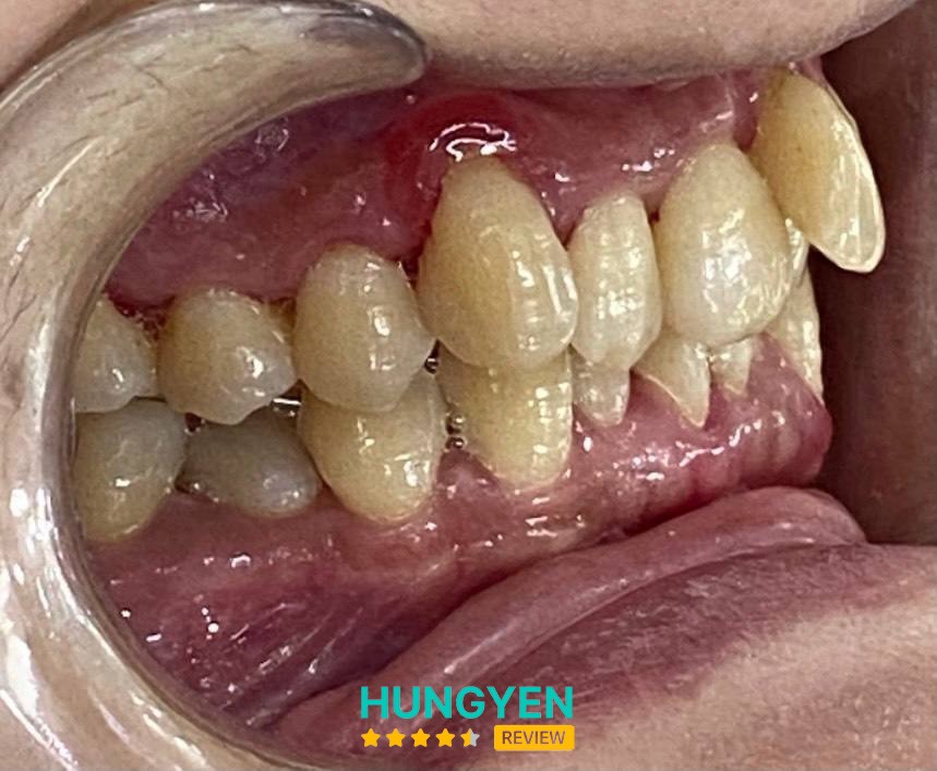 NHA KHOA LÊ HANH – hình ảnh 3