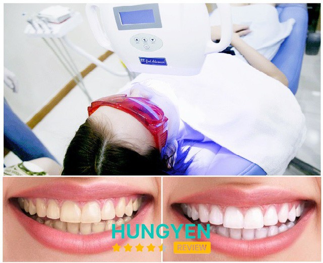 Nha Khoa Việt Dental Trần Lãm – hình ảnh 2