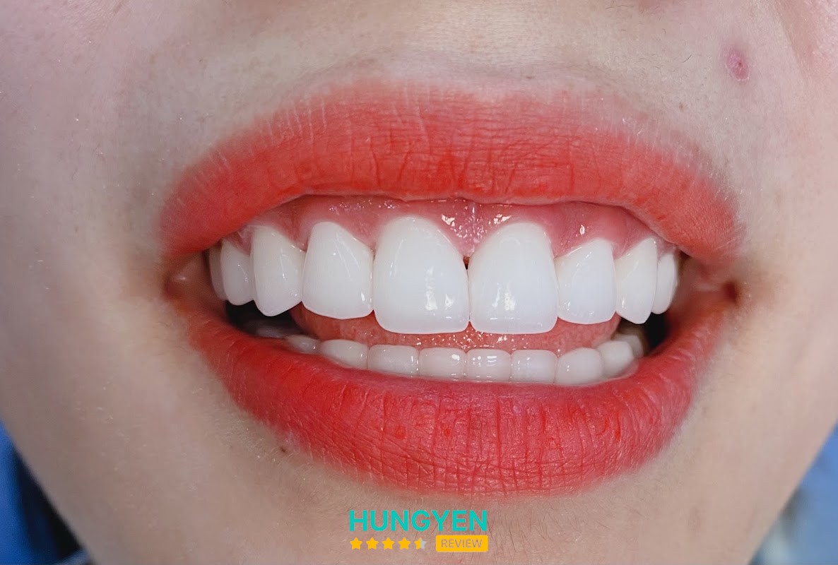 NHA KHOA HẢI CS2 – hình ảnh 2