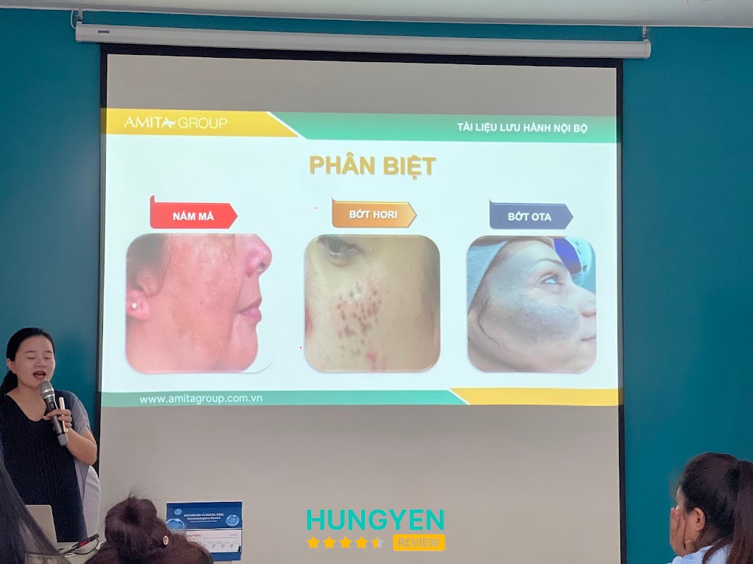Spa Hưng Yên Trị Mụn hình ảnh 2