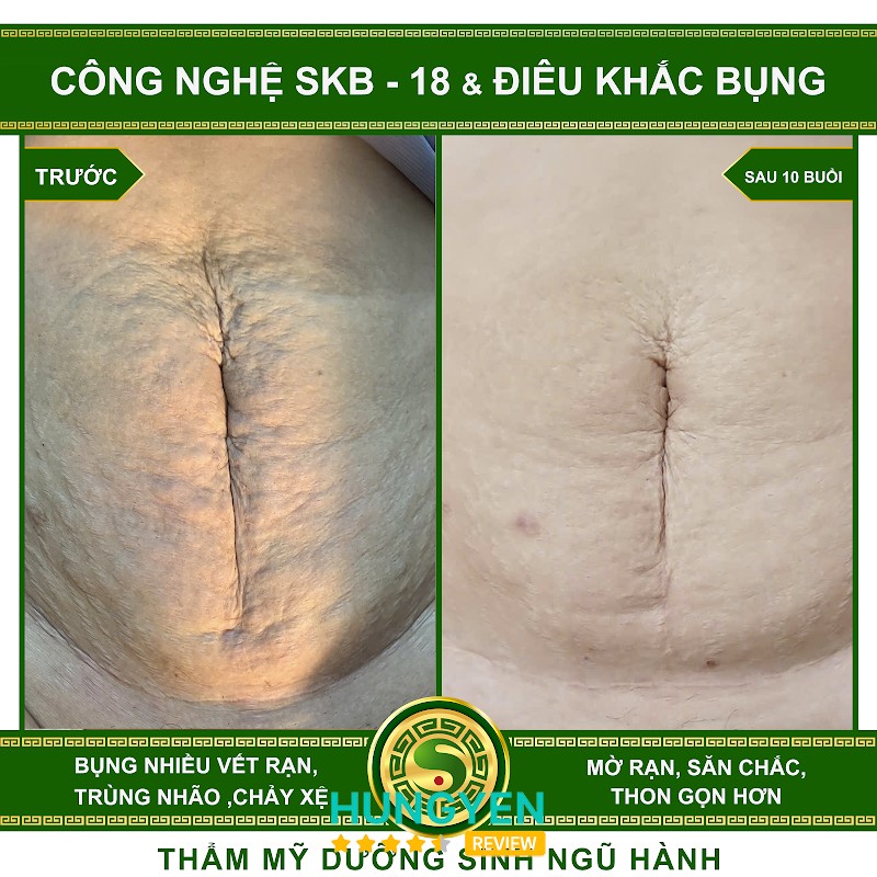 Lin Spa hình ảnh 3