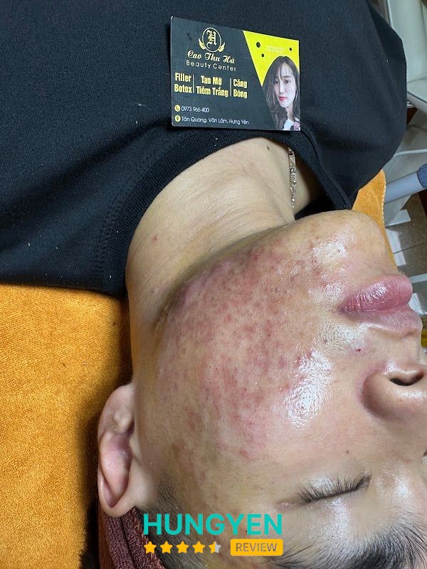 Spa Cao Thu Hà Như Quỳnh