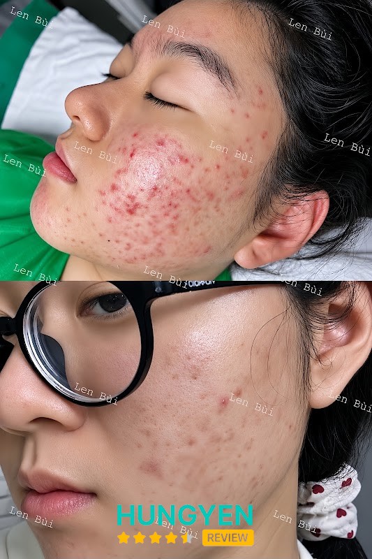 L.LADY Skinlab & Spa – hình ảnh 2