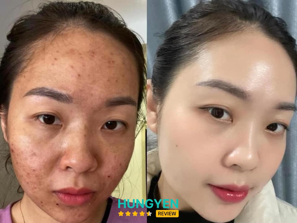 SENNIO & DRLAVIC HƯNG YÊN Phố Hiến