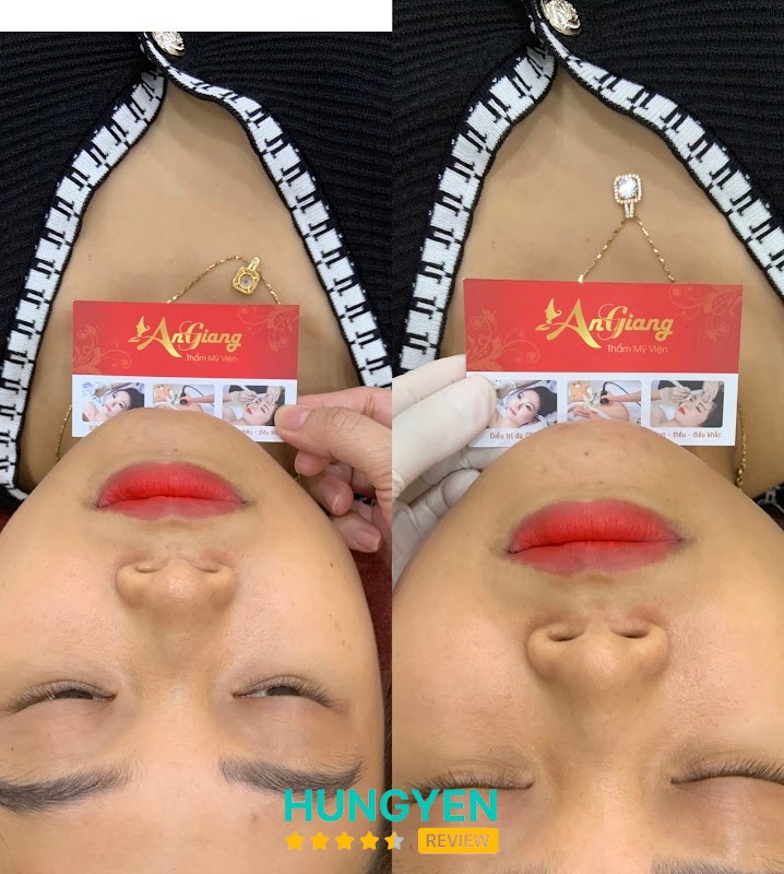 Thẩm Mỹ Viện An Giang CS6 Thái Bình